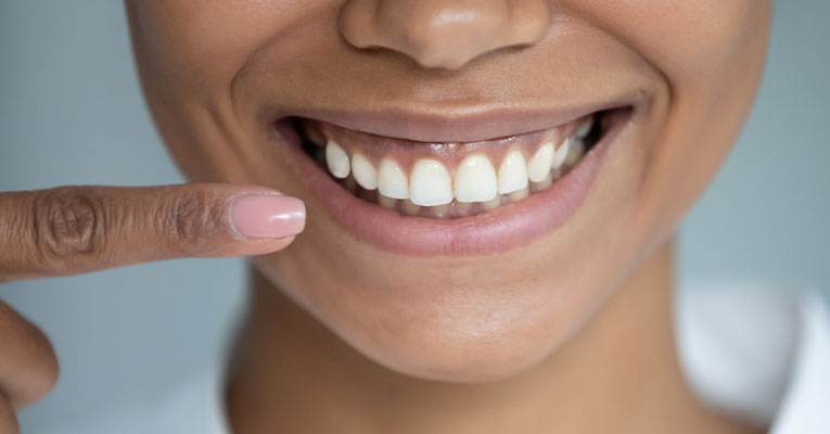 woman pointing at her gums