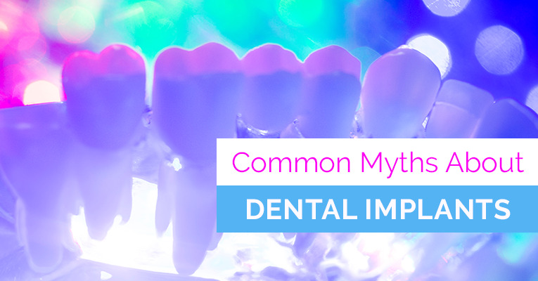 COMMON DENTAL IMPLANT MYTHS