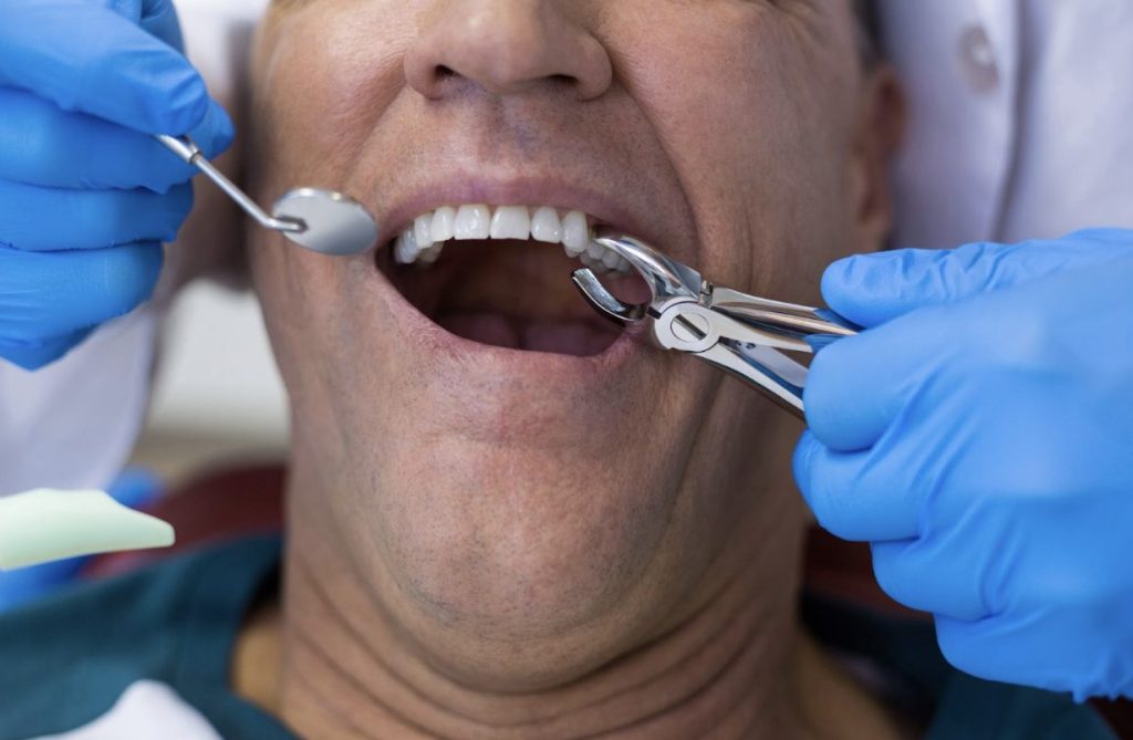 Understanding The Process Of Tooth Extraction
