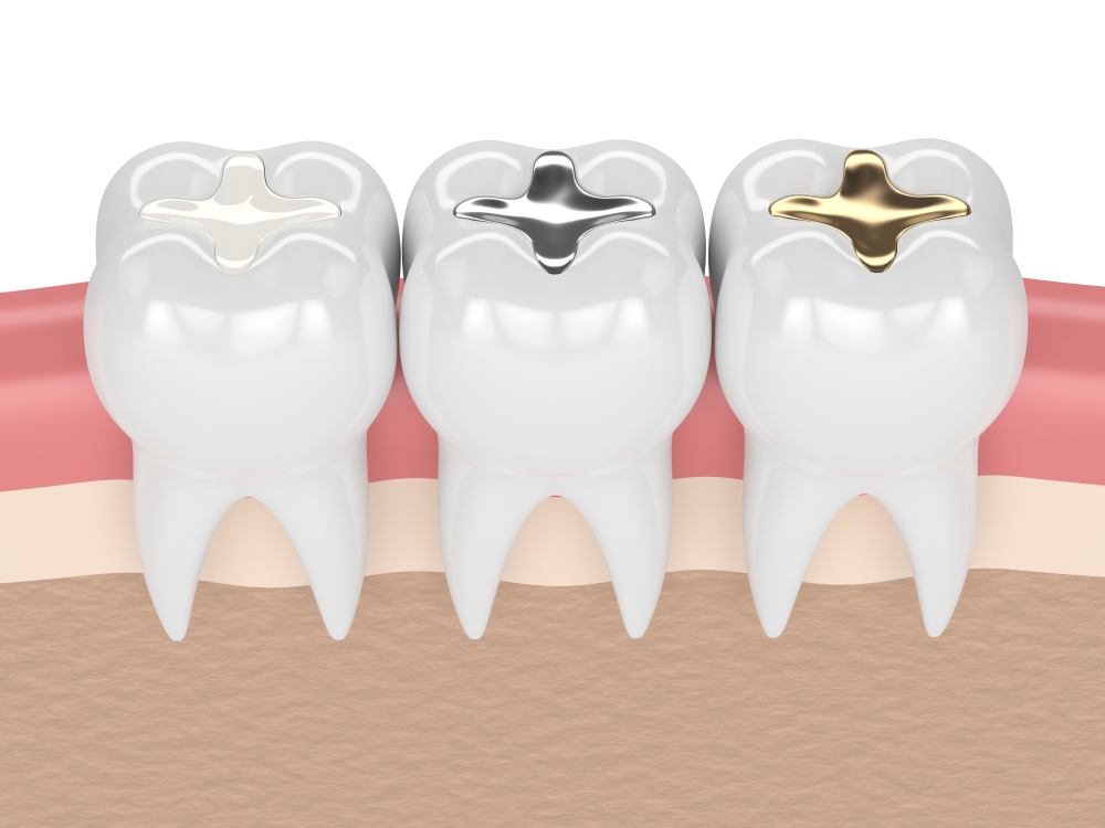 types of filings