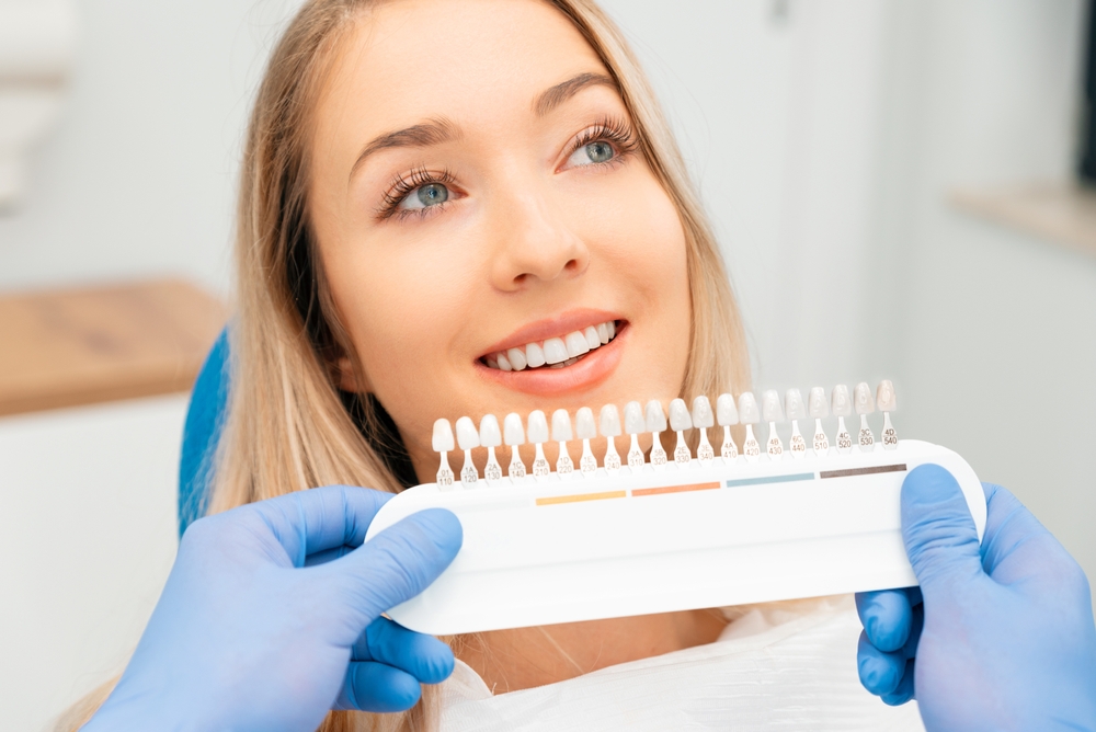 The Benefits of Veneers – How They Can Transform Your Smile